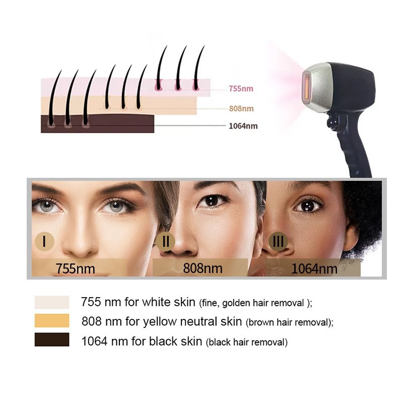 Alma laser 4 Alma laser 4