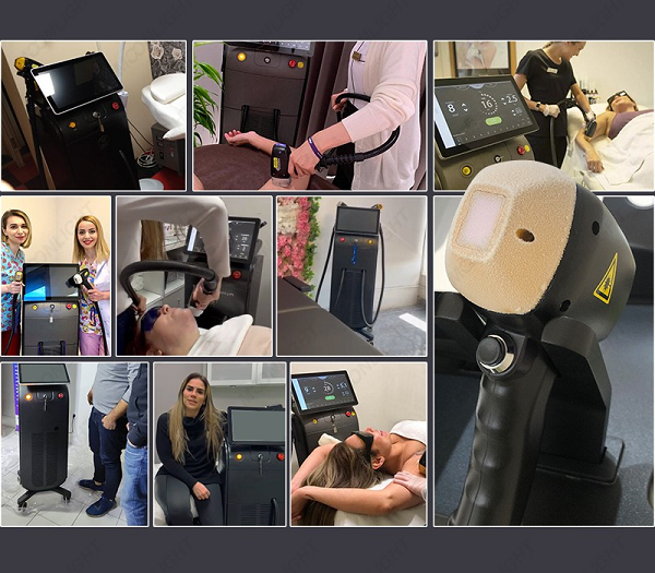 Alma soprano ice titanium feedback 4 Alma soprano ice titanium feedback 4