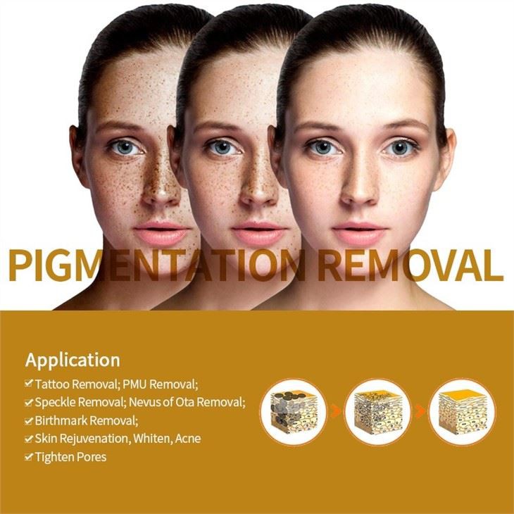 Yag Laser Tattoo Removal Factories
